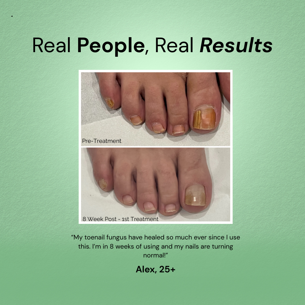 RootClarity™ Nail Serum