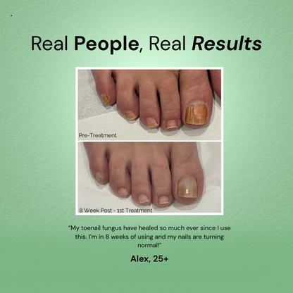 RootClarity™ Nail Serum