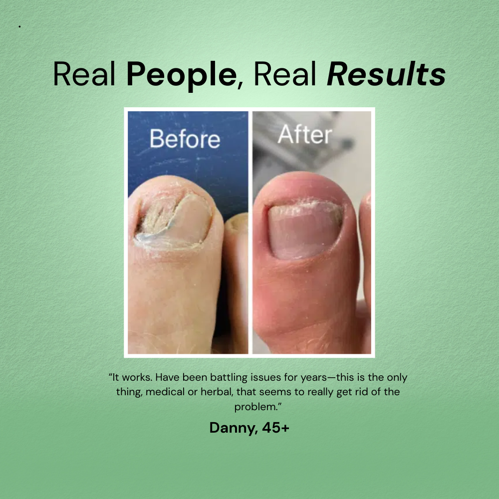 RootClarity™ Nail Serum