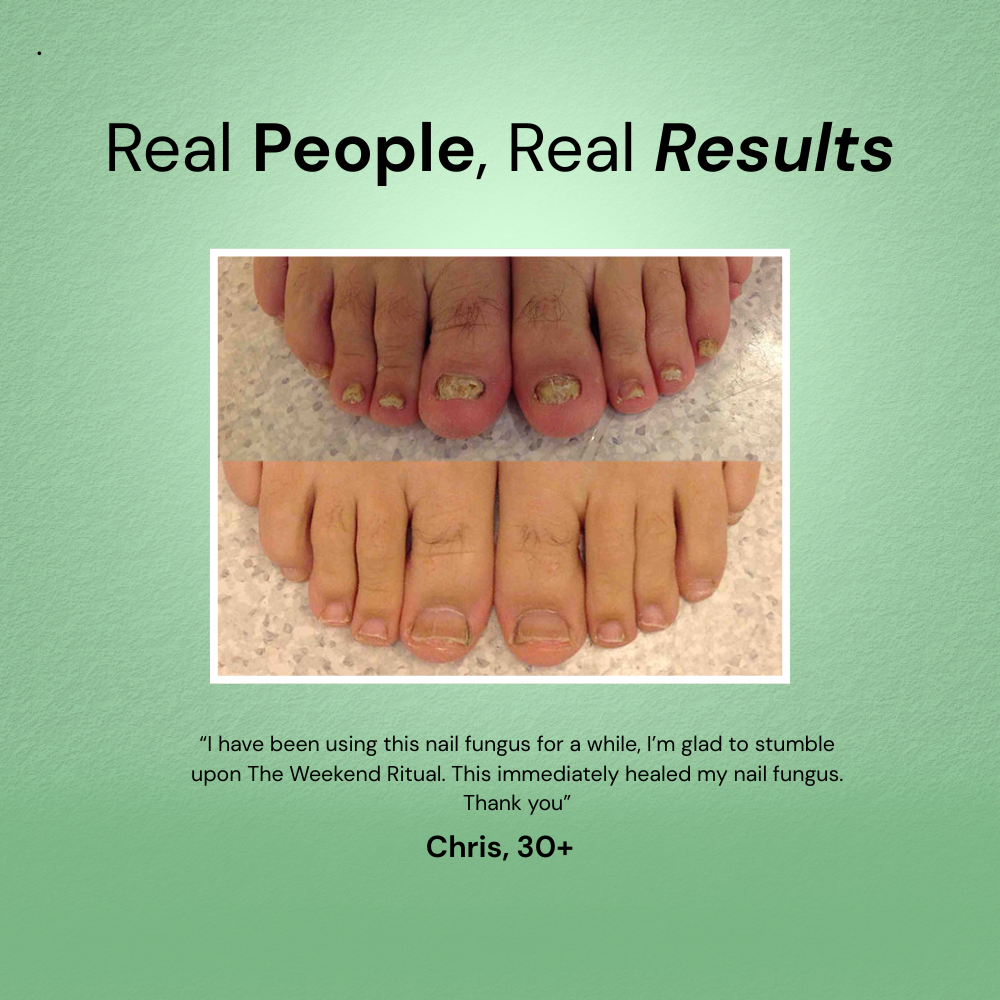 RootClarity™ Nail Serum